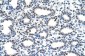SMARCD2 antibody - C-terminal region